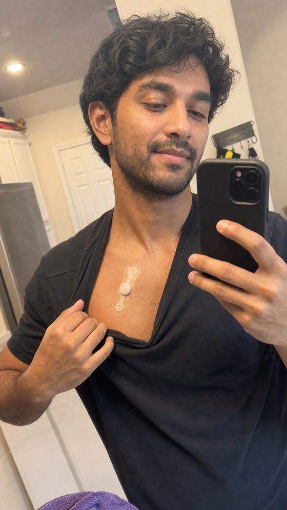 Patient wearing a Zio heart monitor patch